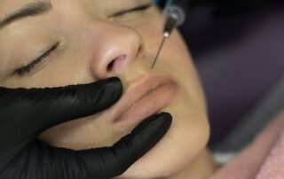 juvederm