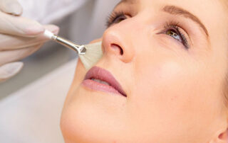 ZO-chemical-peel-total-med-solutions