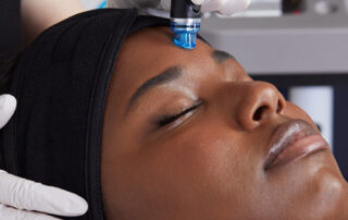 hydrafacial-treatment-total-med-solutions