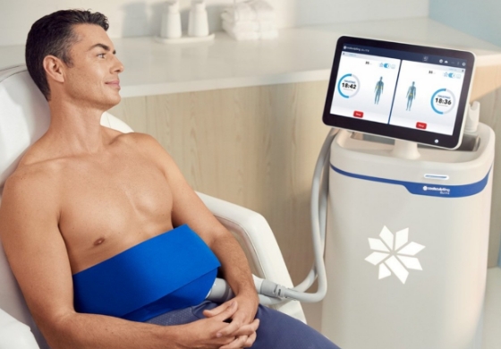 CoolSculpting – 1
