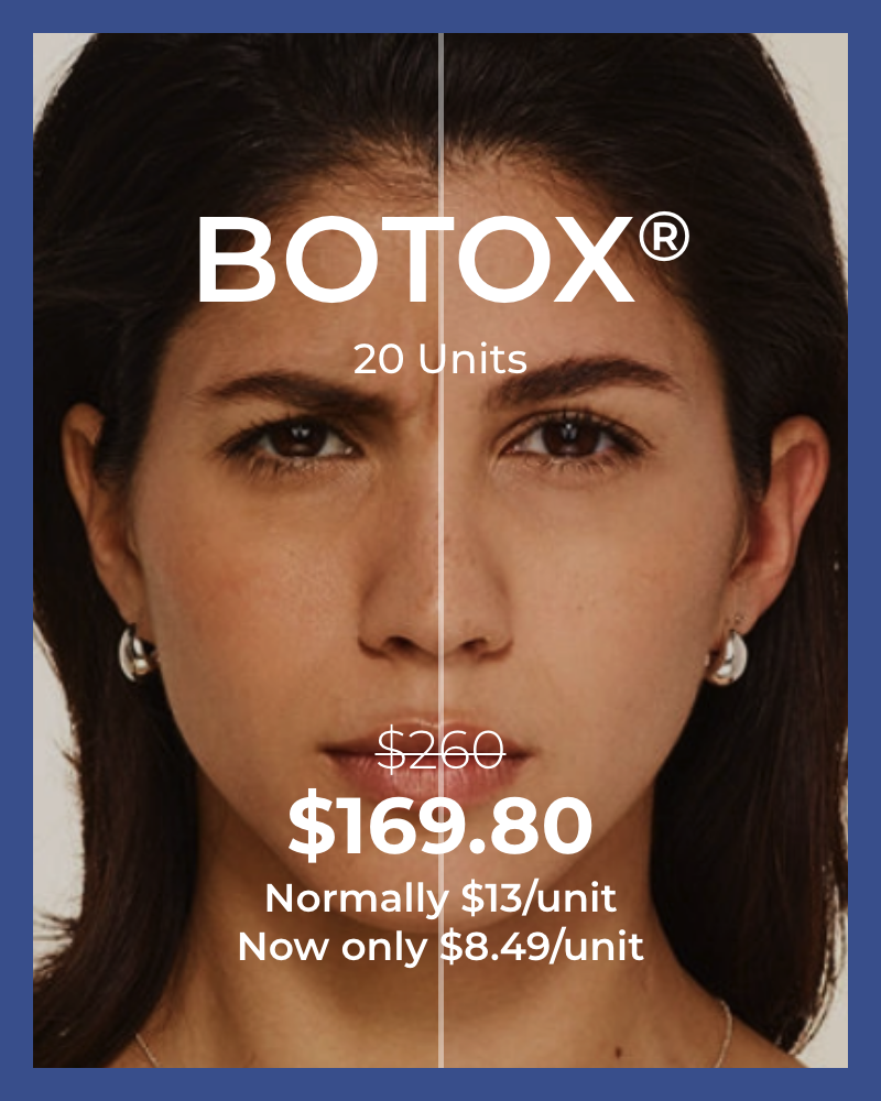 Botox 20 units 169 – 1
