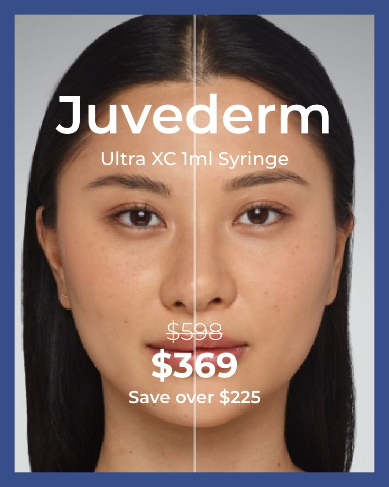Juvederm $369 – 1