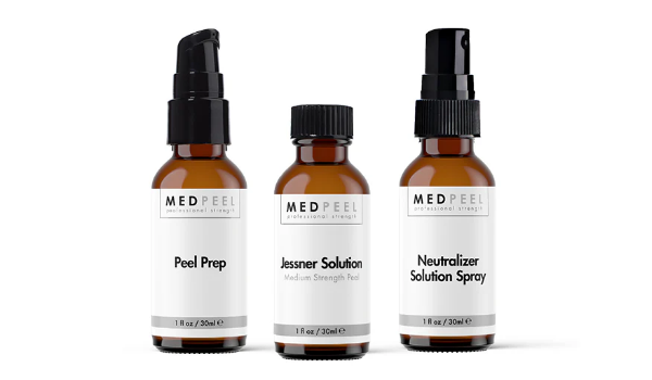Chemical Peel – 2