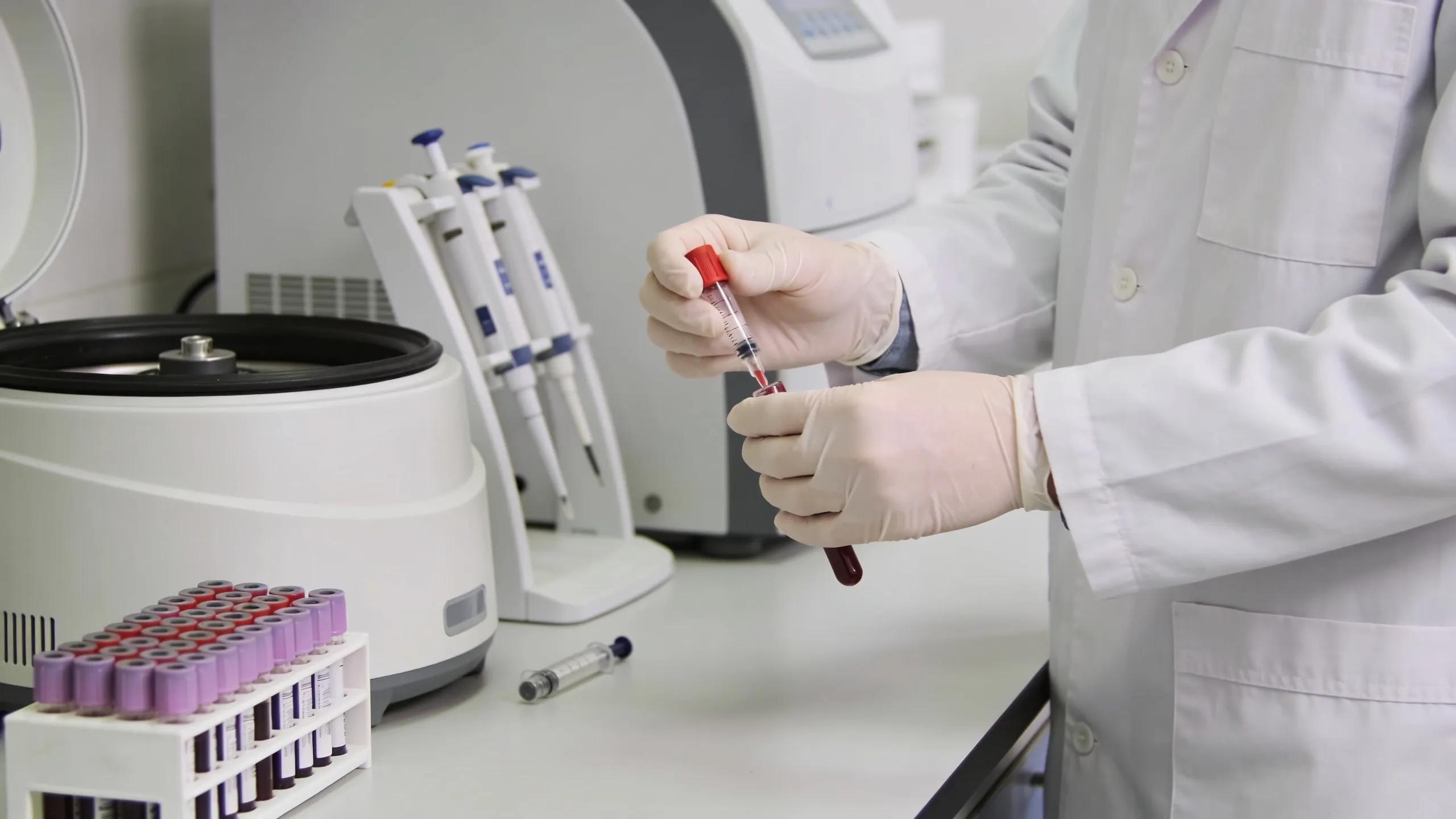 Healthcare provider preparing for hormone blood test emphasizing diagnostic precision.