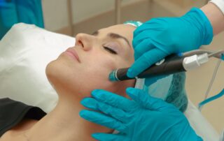 Patient receiving dermabrasion treatment at a med spa